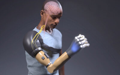 Following the Breakthroughs in Prosthetics